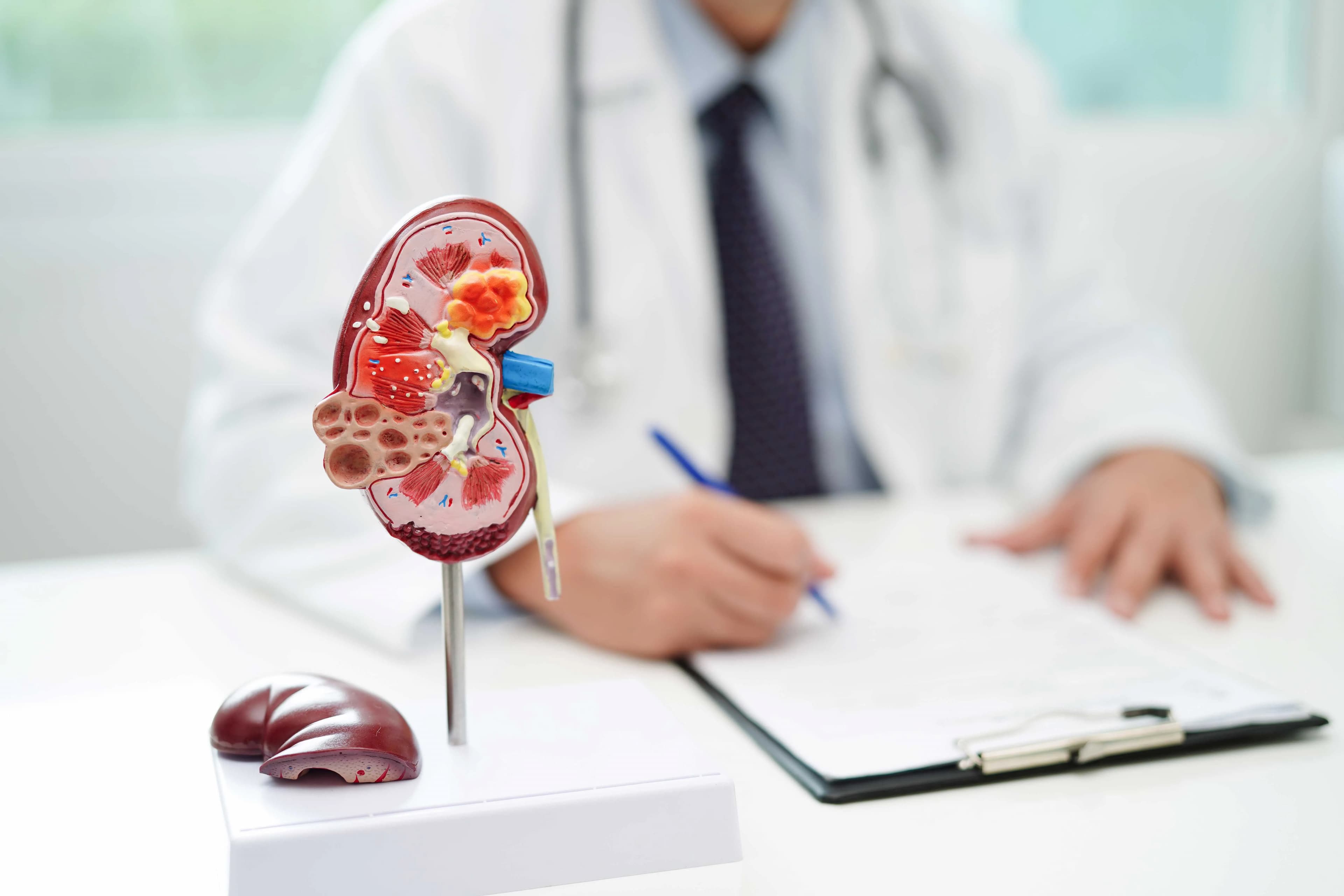 Kidney Stones: Symptoms, Diagnosis & Treatment